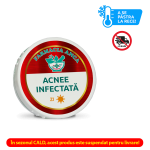 Acnee infectată - Cremă de Zi